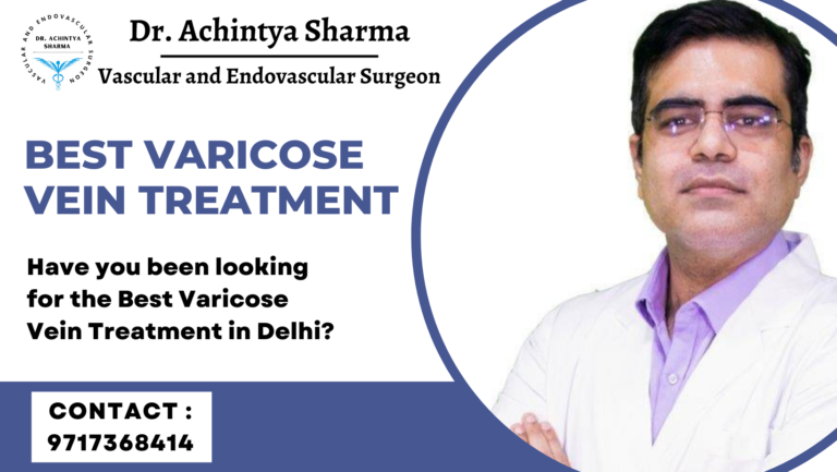 Have you been looking for the Best Varicose Vein Treatment in Delhi?