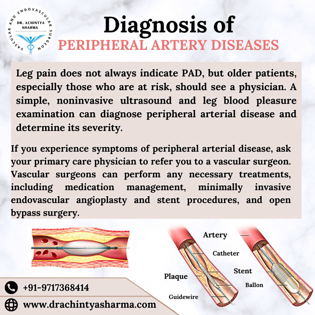 Best guide and medications for Peripheral Artery Disease treatment