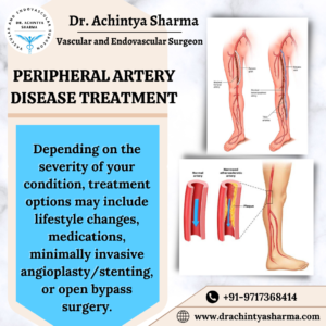 Peripheral Artery Diseases