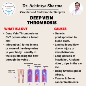 Deep Vein Thrombosis