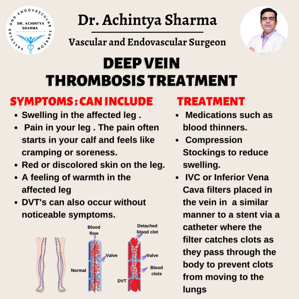Can You Reverse Deep Vein Thrombosis At Jai Reading Blog