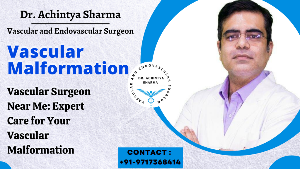 Vascular Malformation Treatment