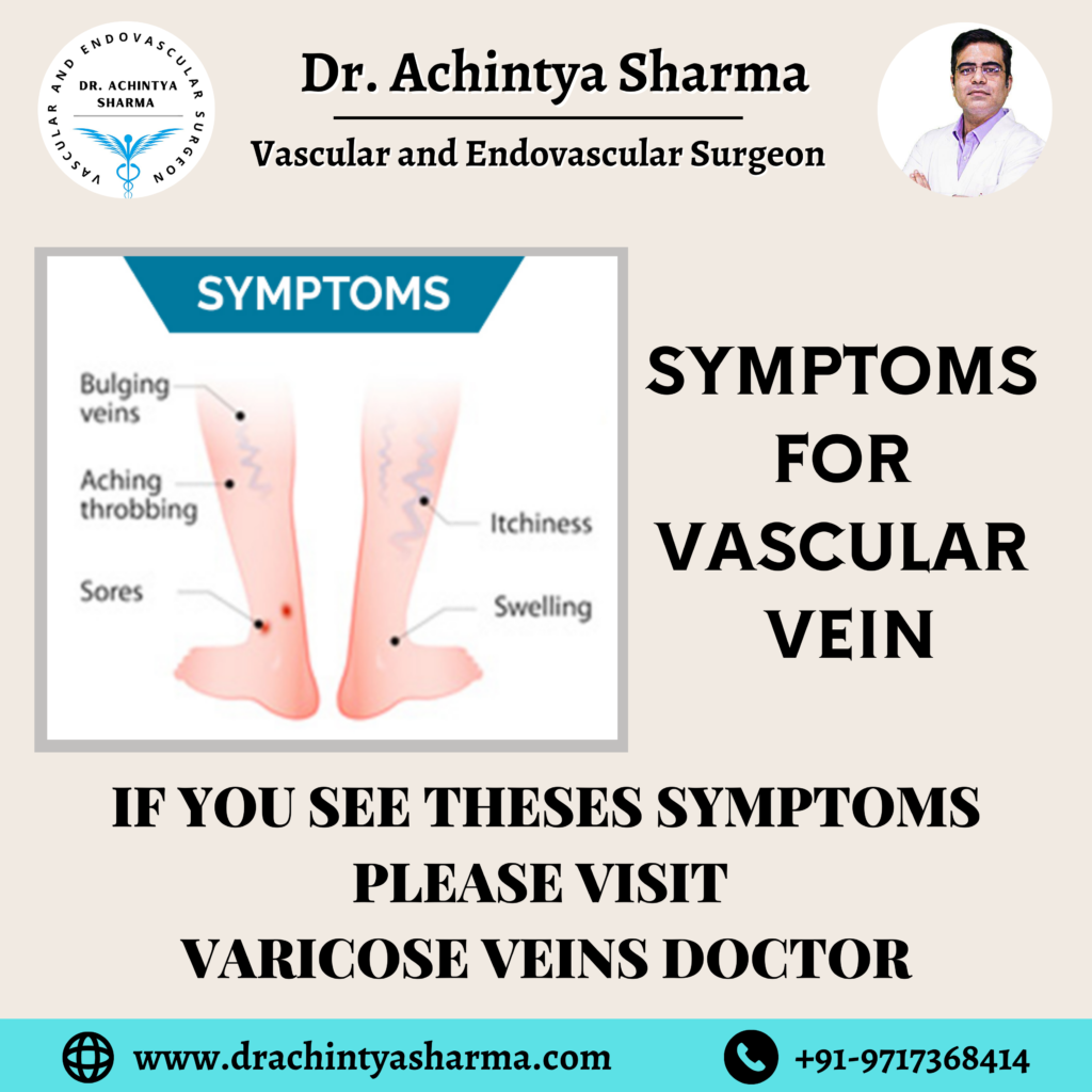 Varicose Veins Doctor