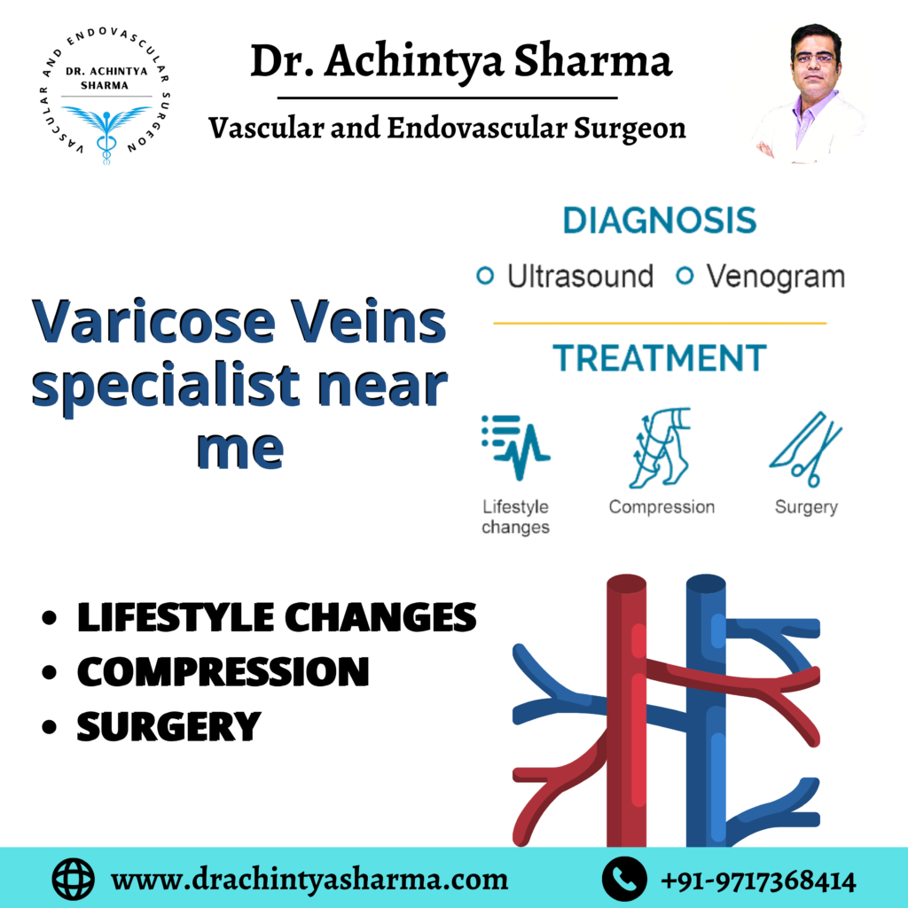 varicose veins specialist near me