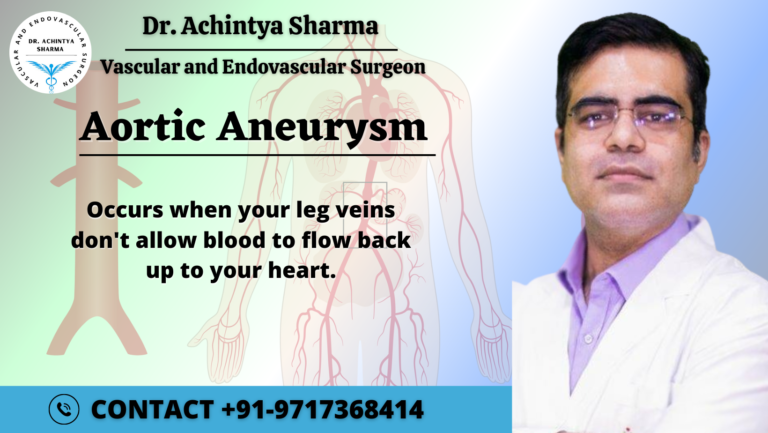 Aortic Aneurysm: Causes, Risk Factors, and Prevention Methods