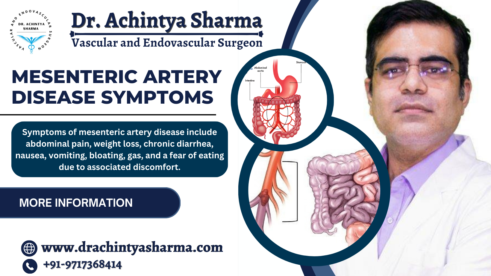 How to Recognize the Signs of Mesenteric Artery Disease Symptoms