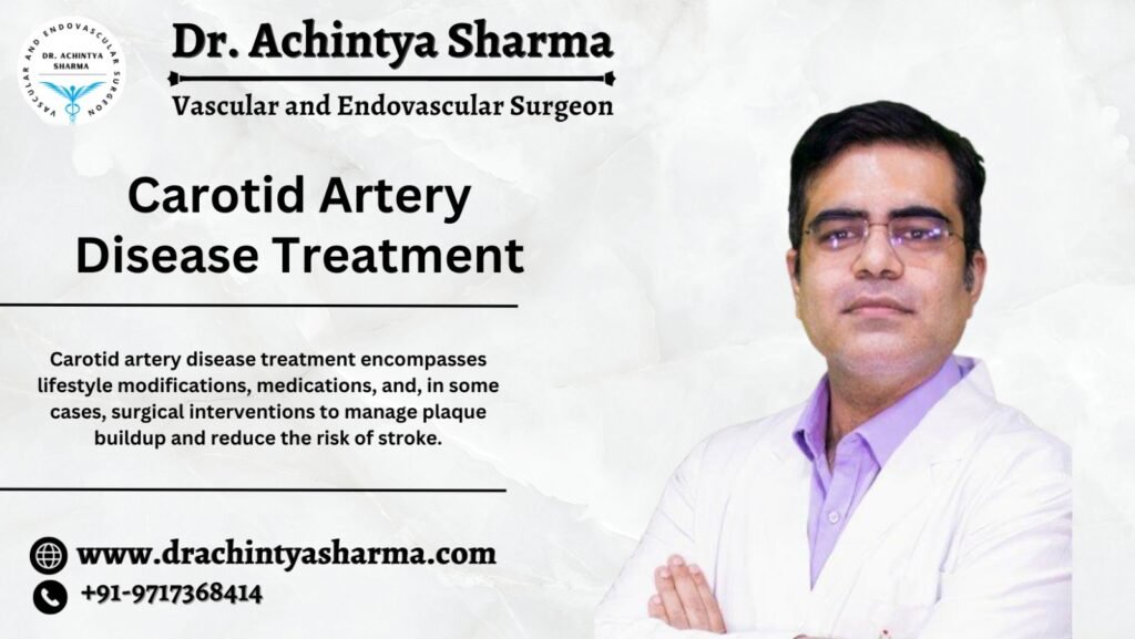 carotid artery disease treatment
