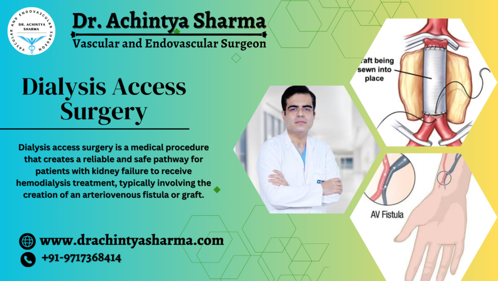 dialysis access surgery