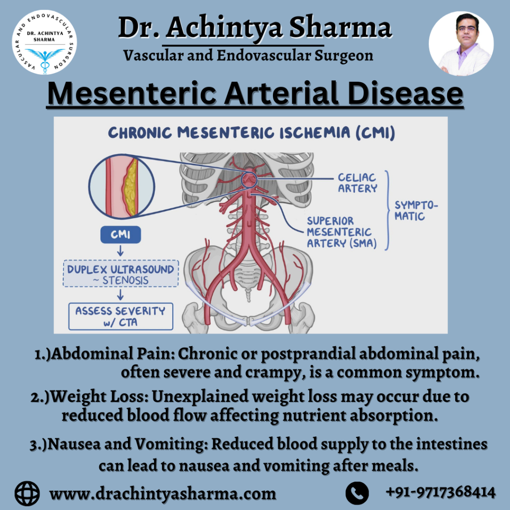 Mesenteric artery disease symptoms