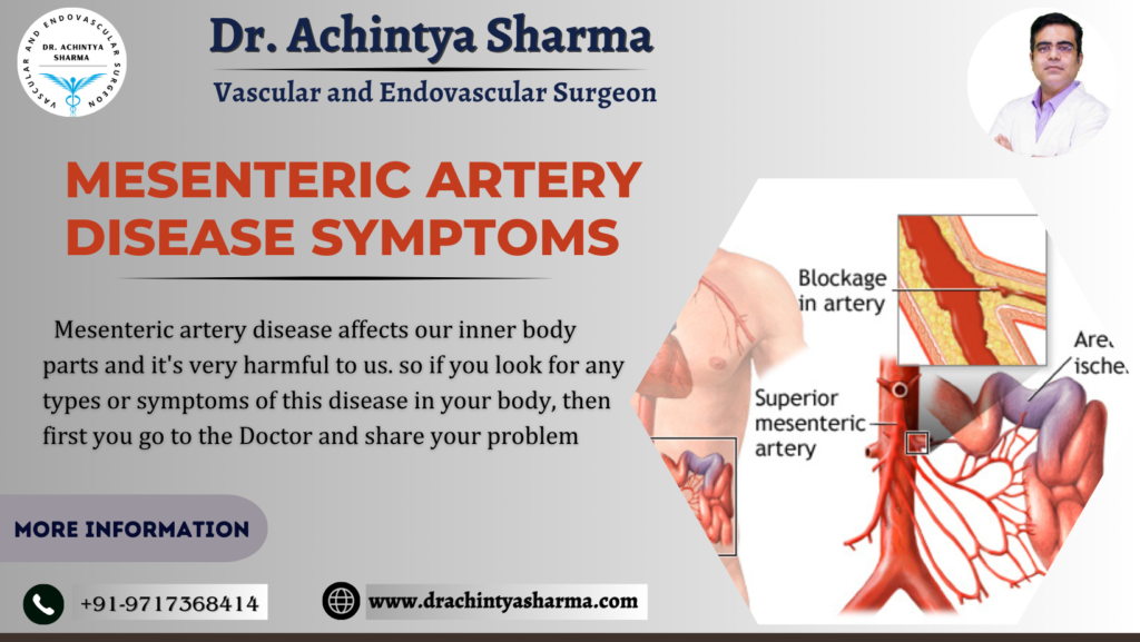 mesenteric artery disease symptoms