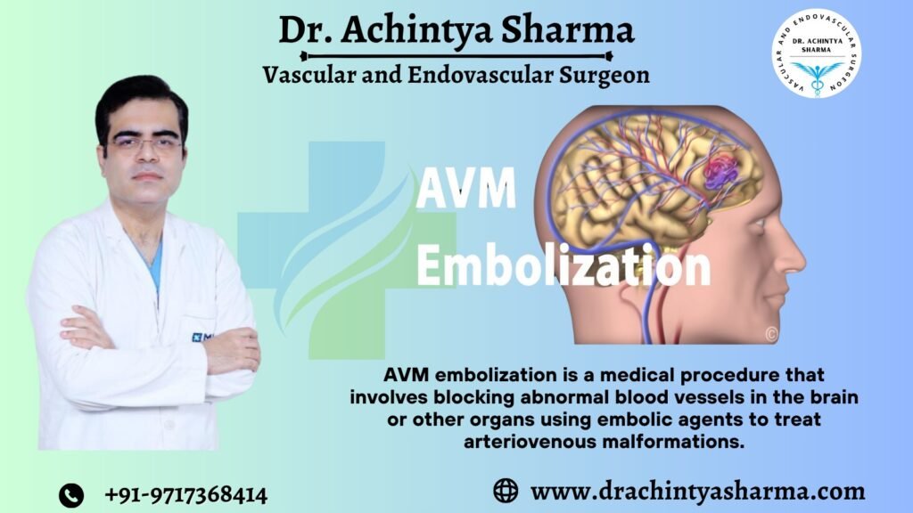 AV Embolization