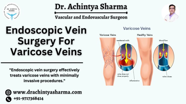 Endoscopic vein surgery for varicose veins is the most effective and successful