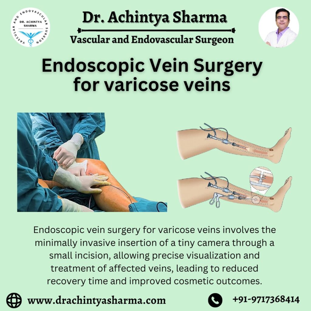 endovascular surgery