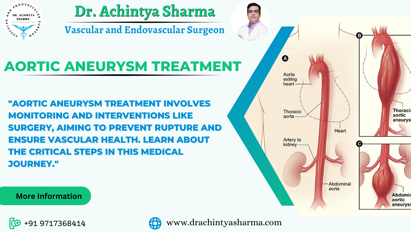 Overview of Aortic Aneurysm treatment
