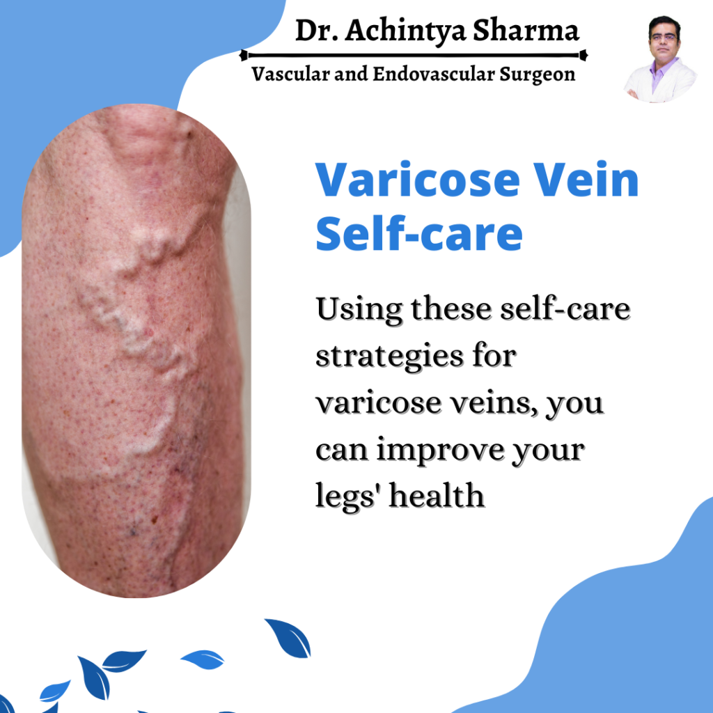 Varicose Vein  Self-care