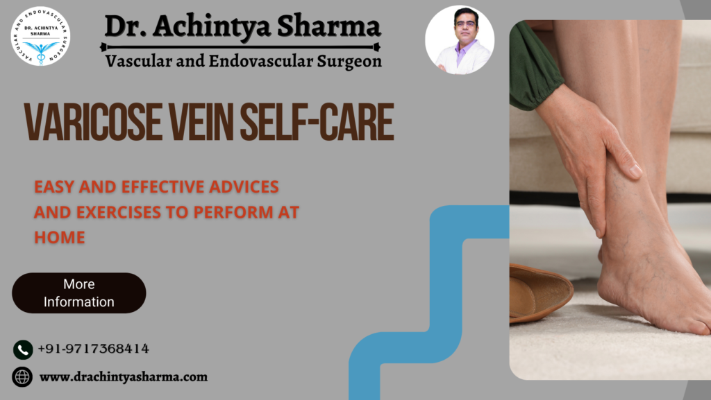 Varicose Veins Shelf-care