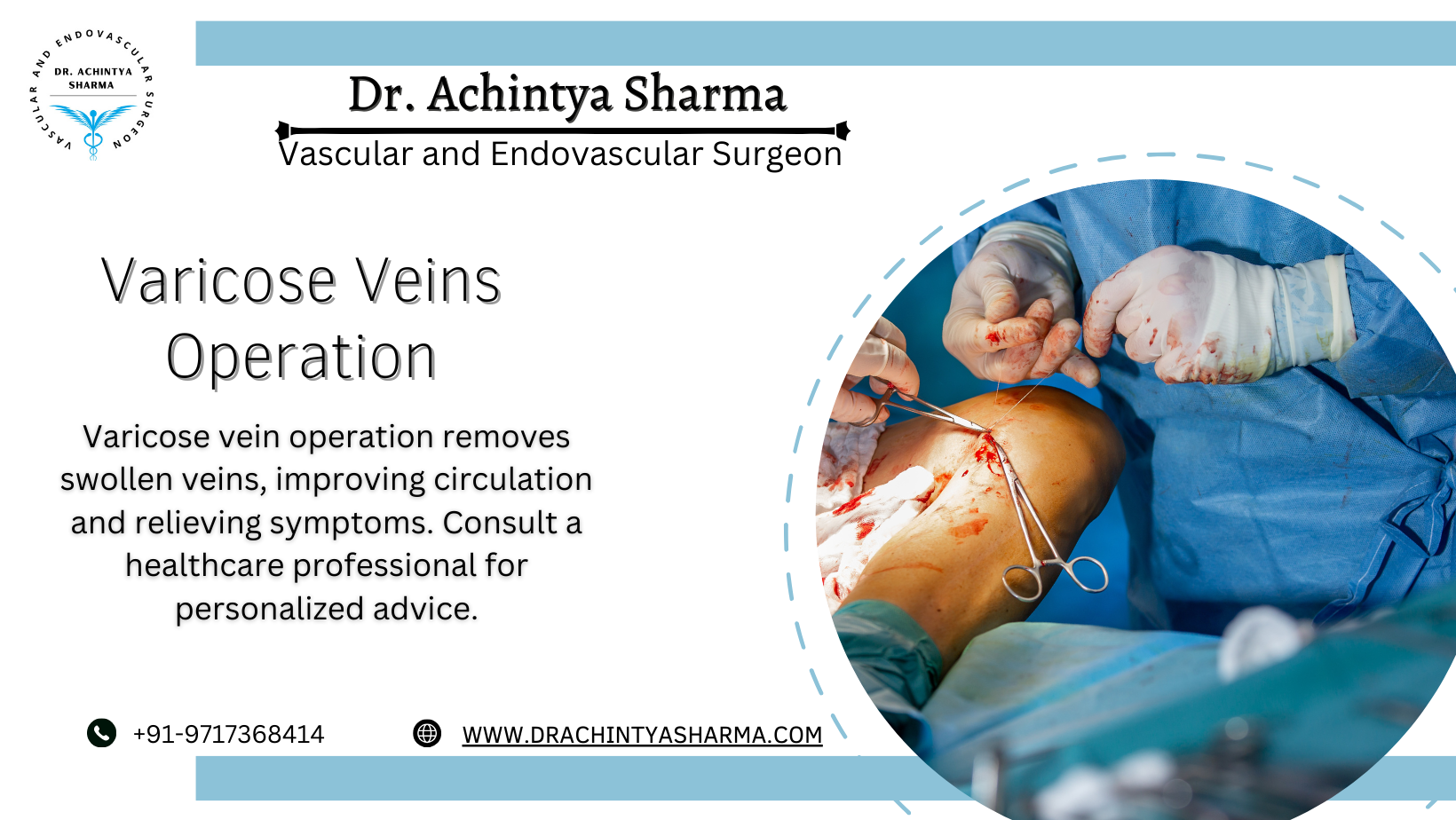 Choose the Right Surgeon for a Varicose veins operation