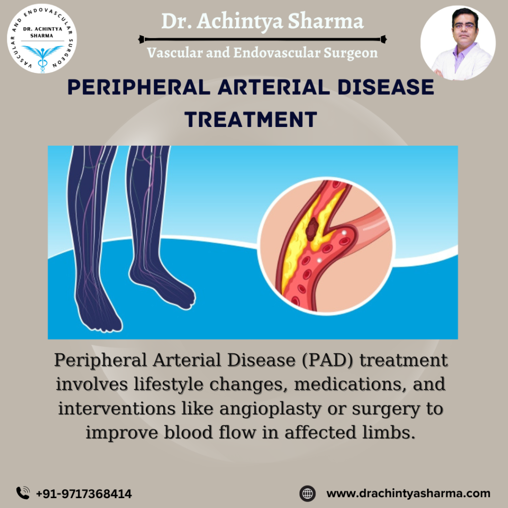 peripheral arterial disease treatment
