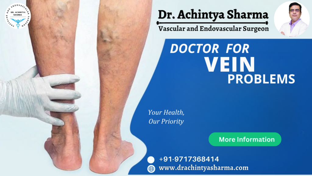doctor for vein problems