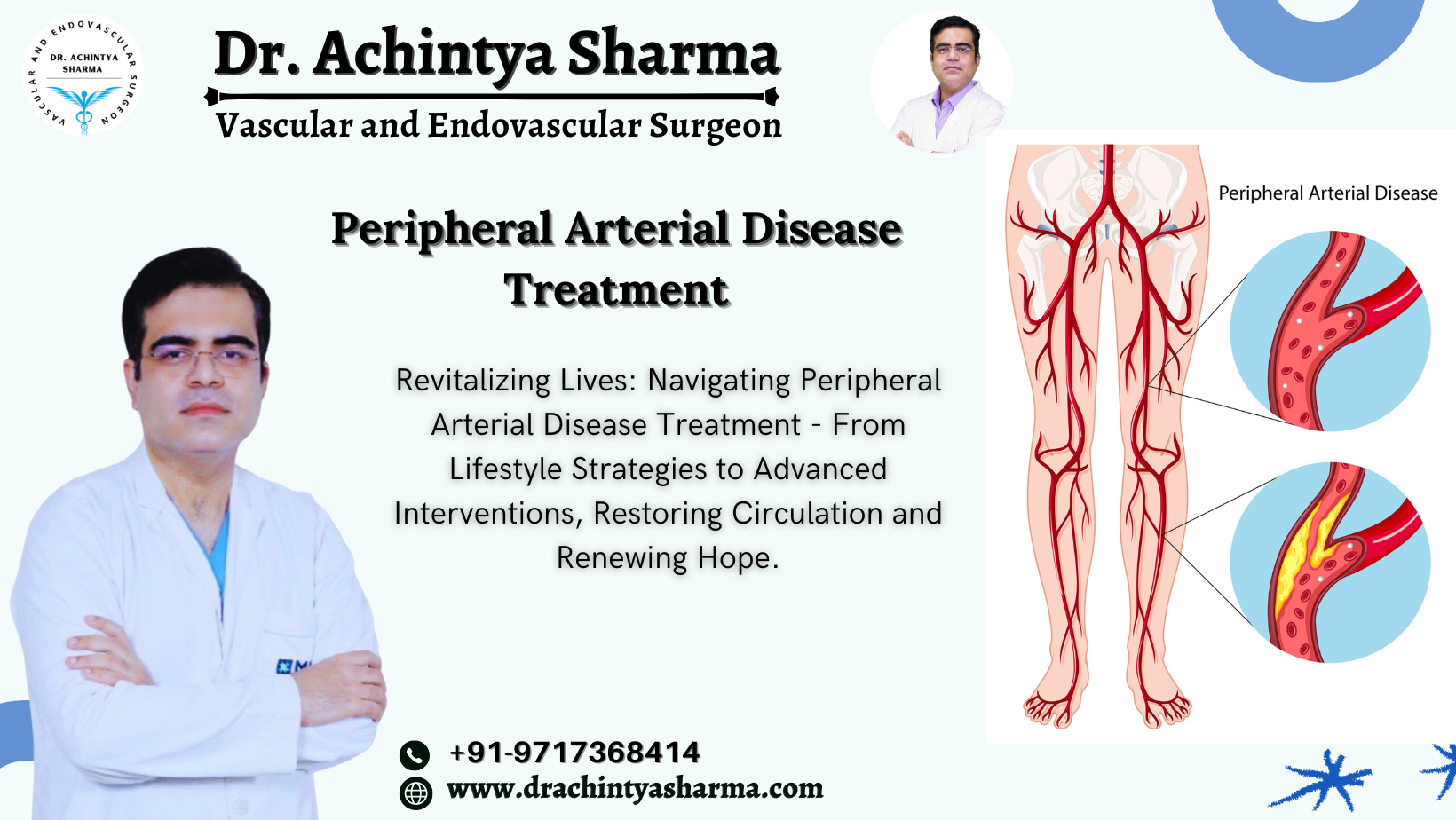 Understanding Peripheral Arterial Disease & Insights into Peripheral Arterial Disease Treatment
