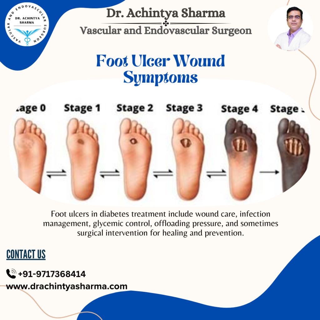 Foot Ulcers in Diabetes Treatment