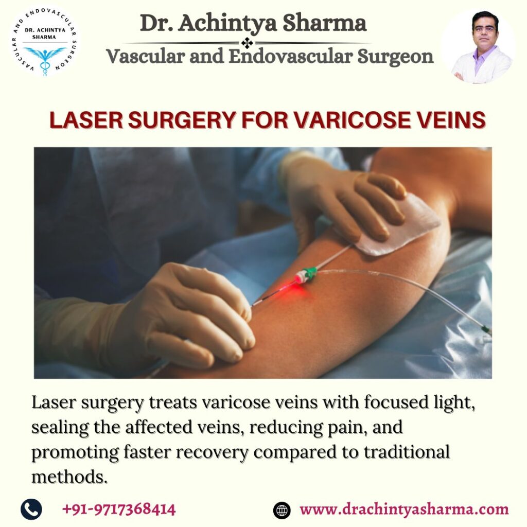 Laser Surgery for varicose veins
