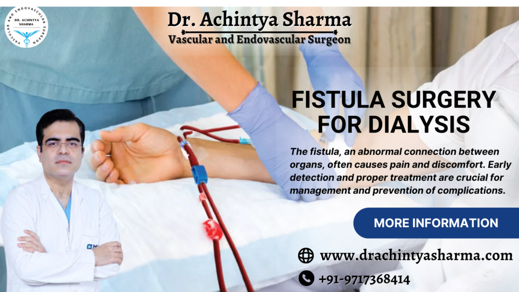 Fistula Surgery for Dialysis