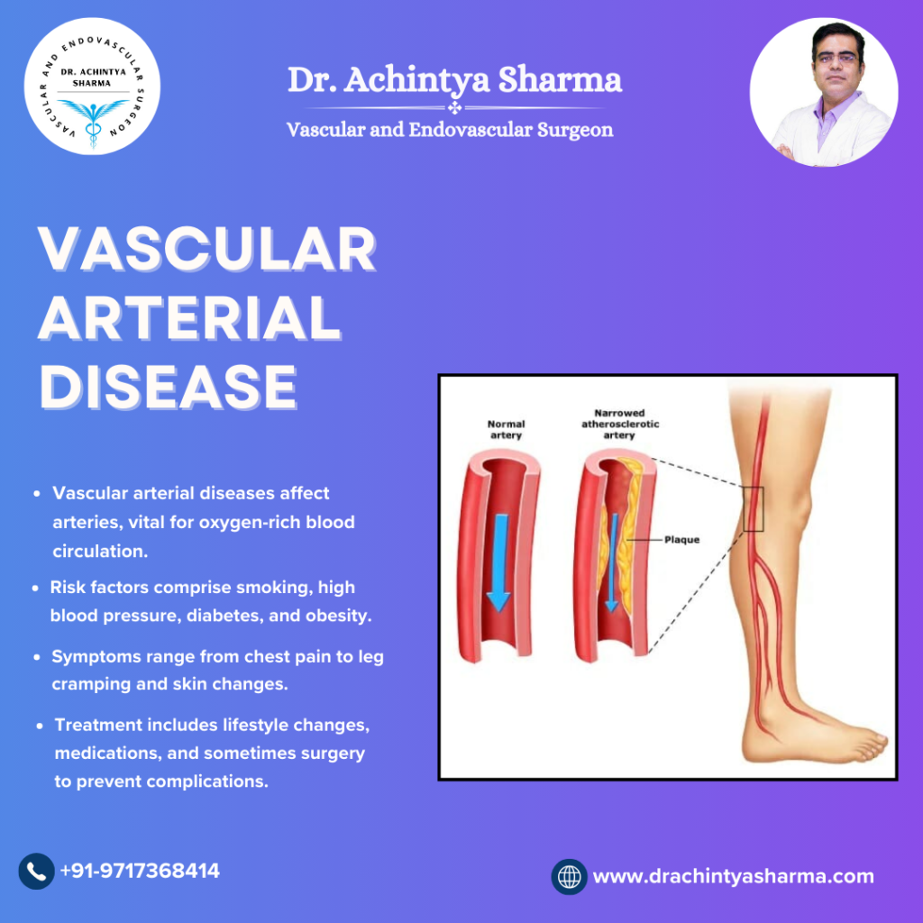 Vascular Arterial Disease