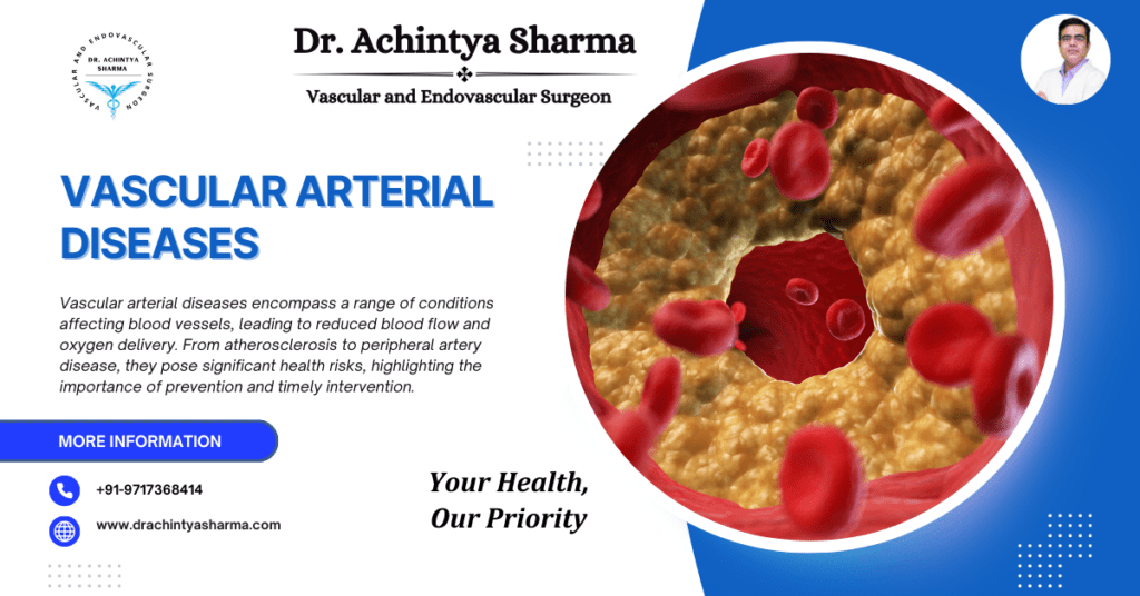 Vascular Arterial Disease