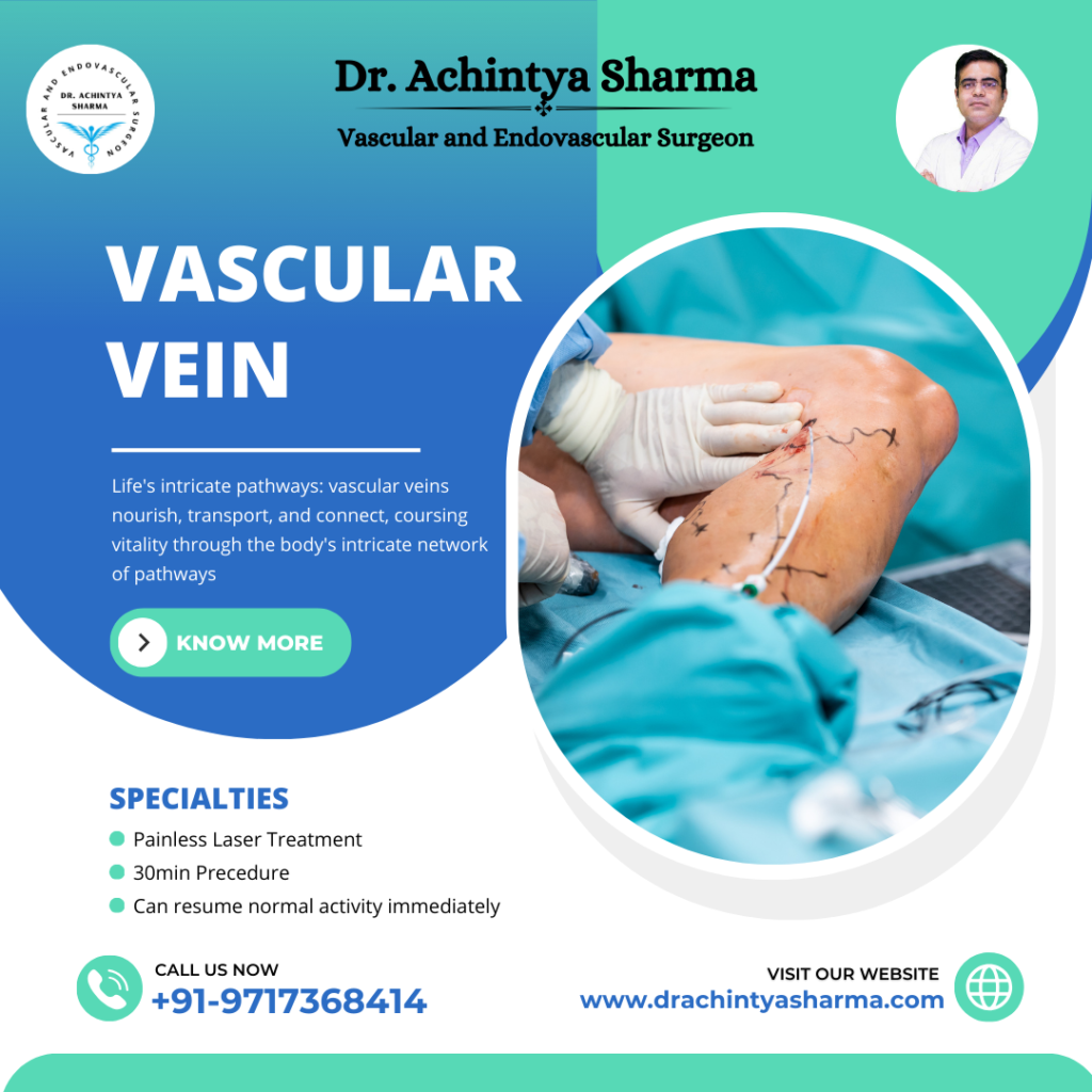 vascular vein doctor