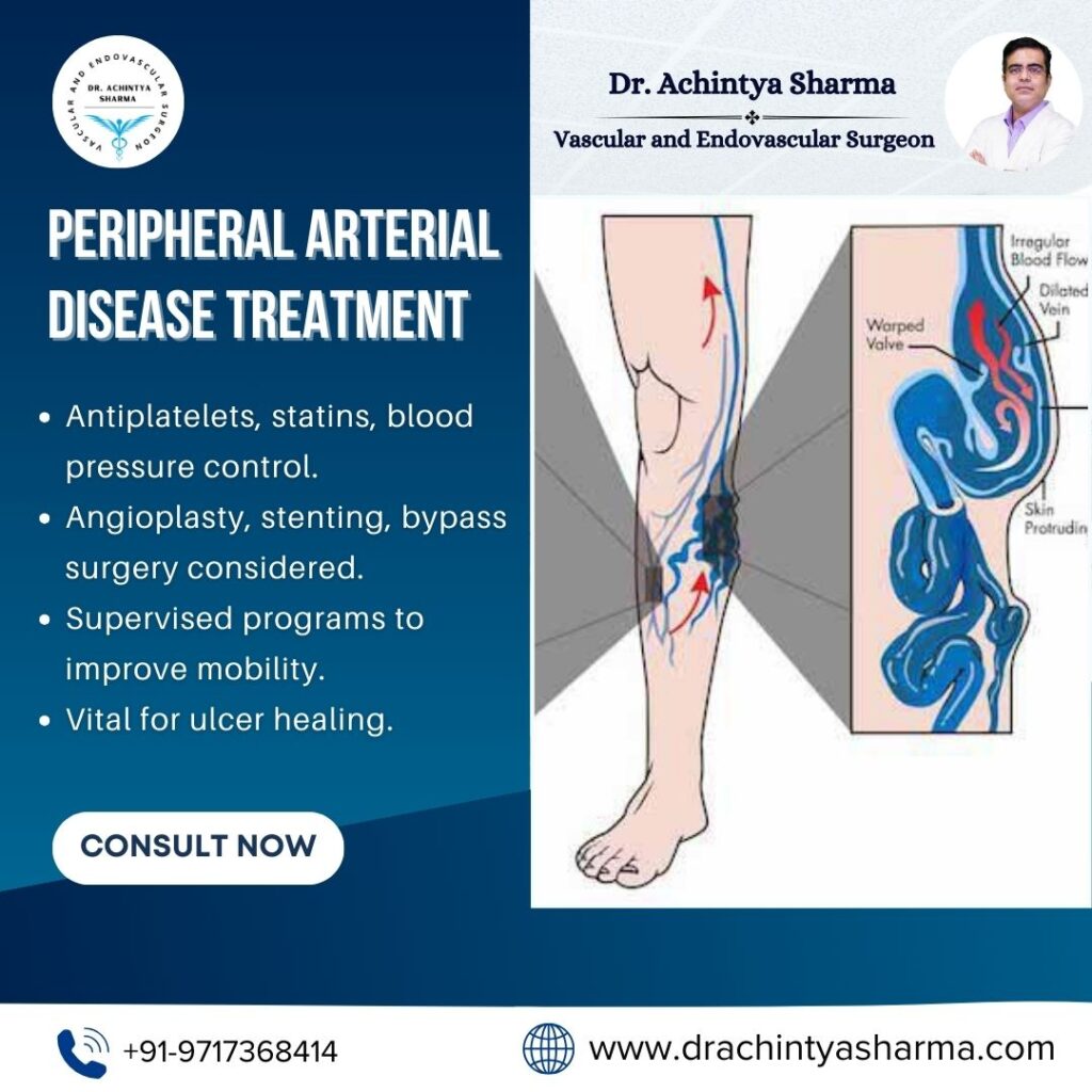 Education on Peripheral Arterial Disease (PAD) and Its Management