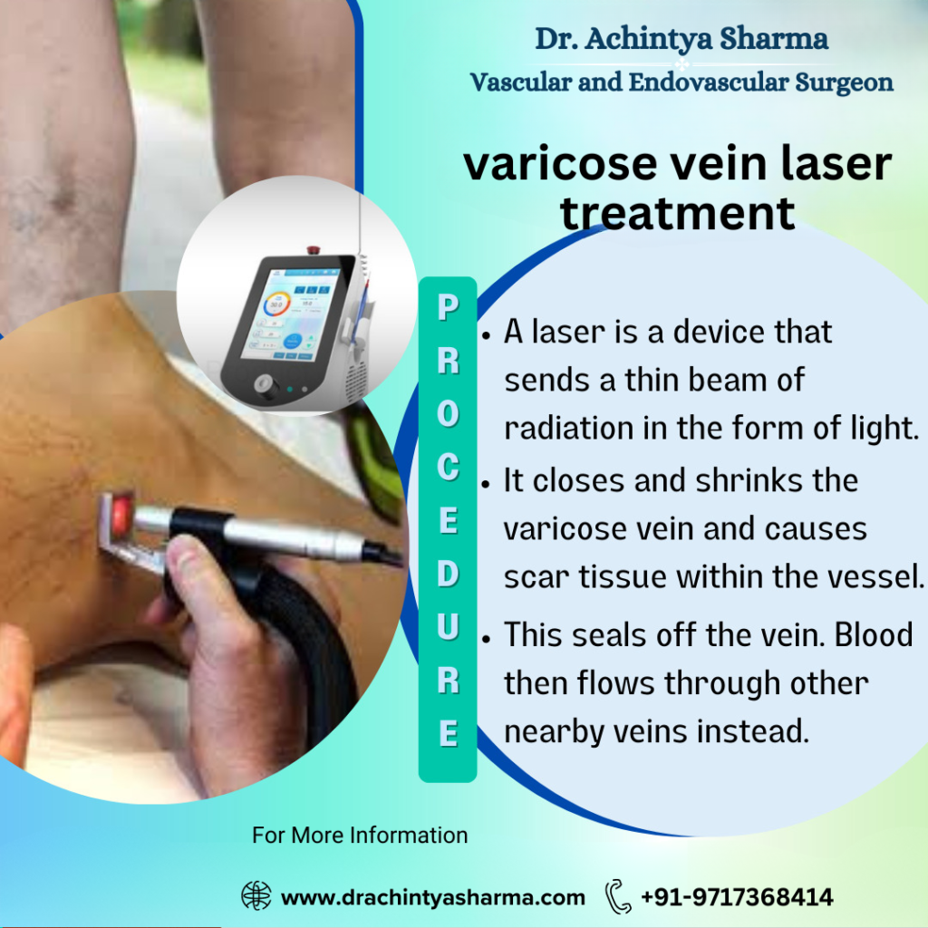  Varicose Vein Laser Treatment
