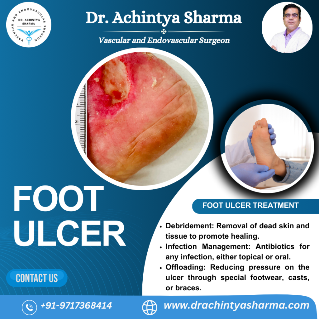 foot ulcer treatment 