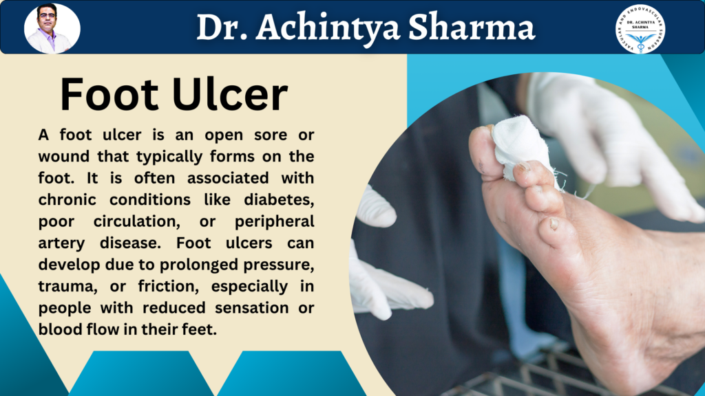 Foot ulcer treatment.