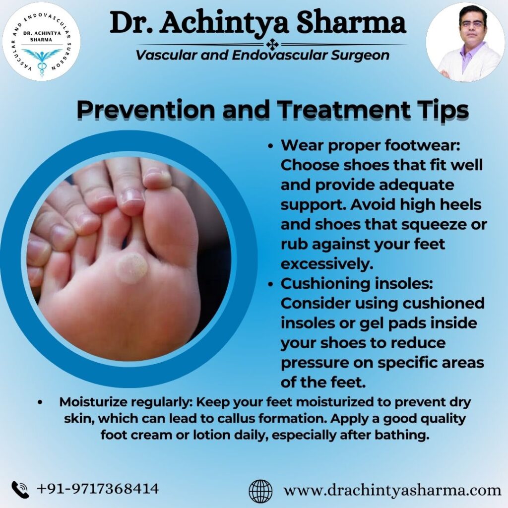 Diagram illustrating the signs of diabetic foot ulcers.
