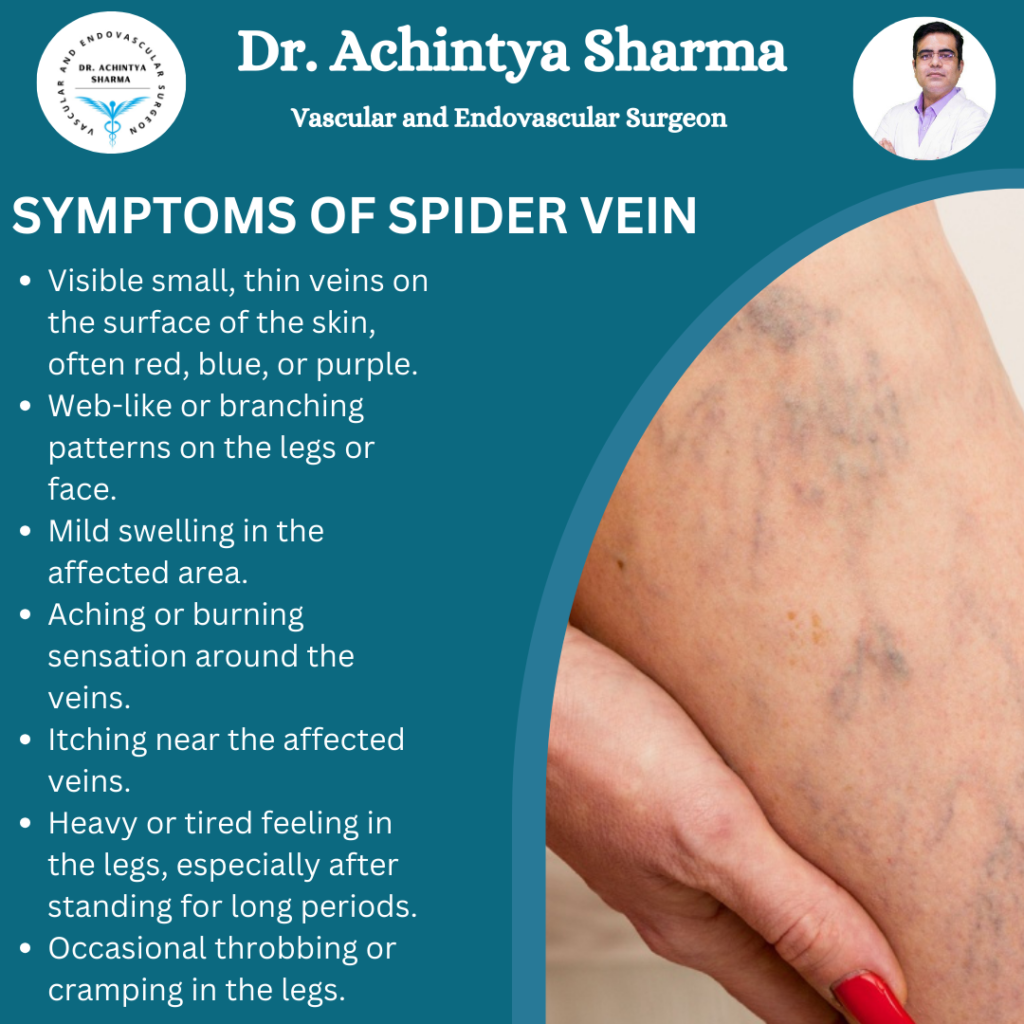 Spider veins on leg.