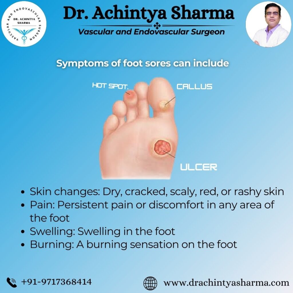 Image showing common symptoms of diabetic foot ulcers.