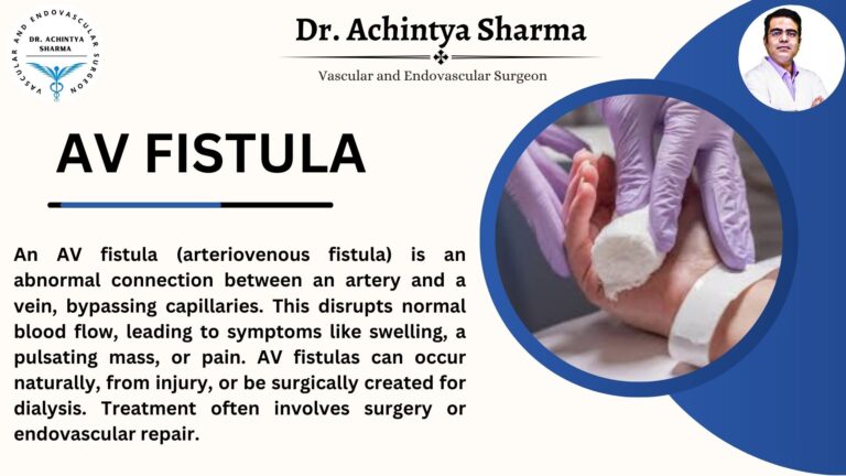 Atrioventricular Fistula: The Hidden Connection Affecting Your Heart and Health