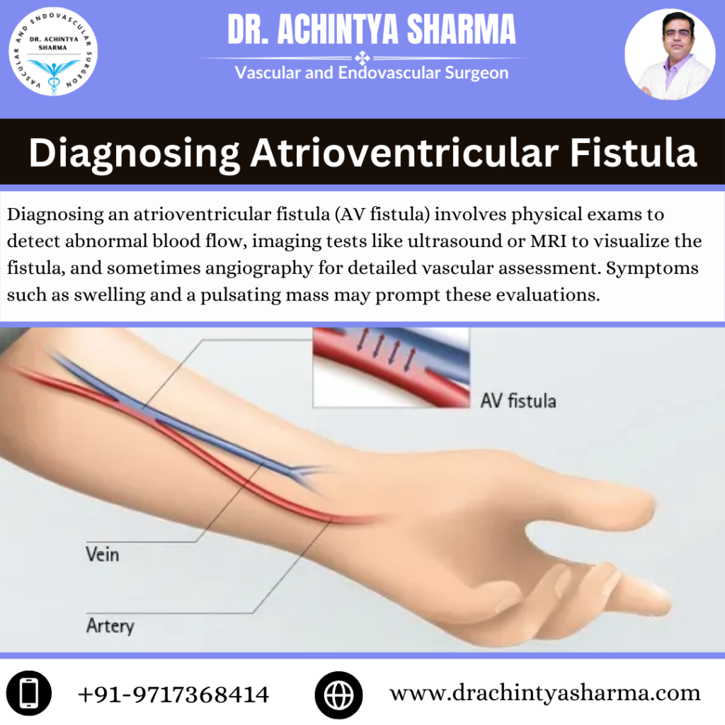 diagnosing atrioventricular fistula showing a diagram.