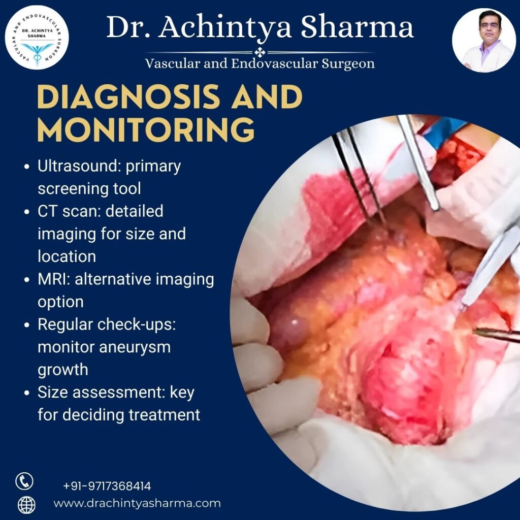 Aortic Aneurysm