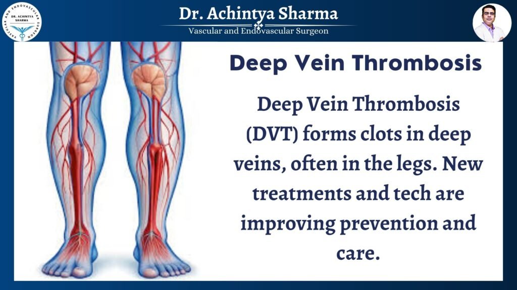 "Deep Vein Thrombosis info with prevention and care tips"