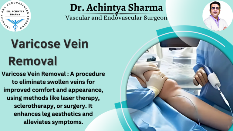 Exploring Varicose Vein Removal: Comfort and Aesthetics