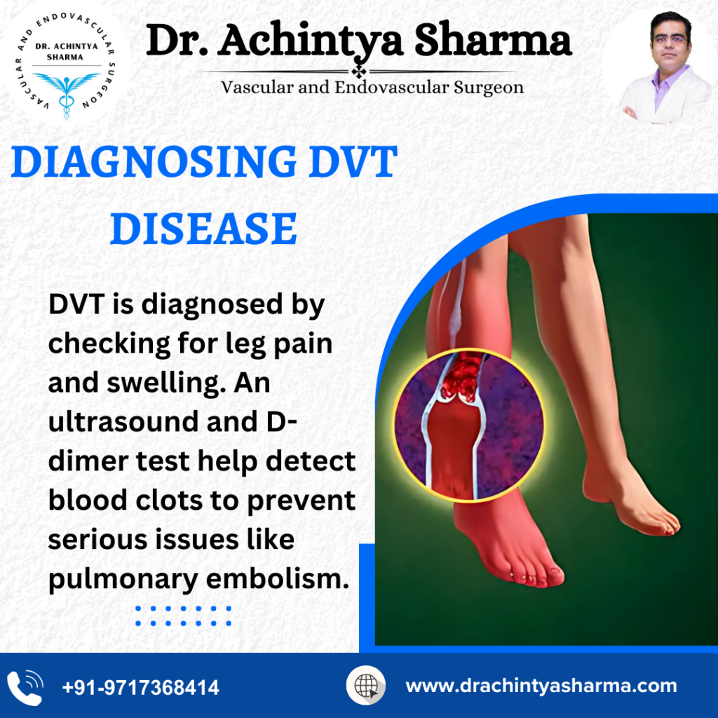 Diagnosing DVT Disease