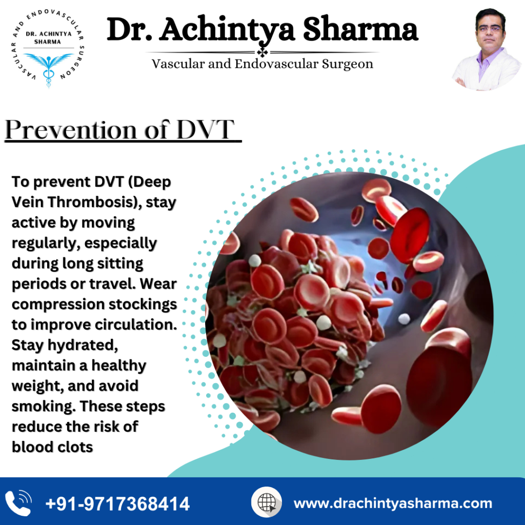 Prevention of DVT