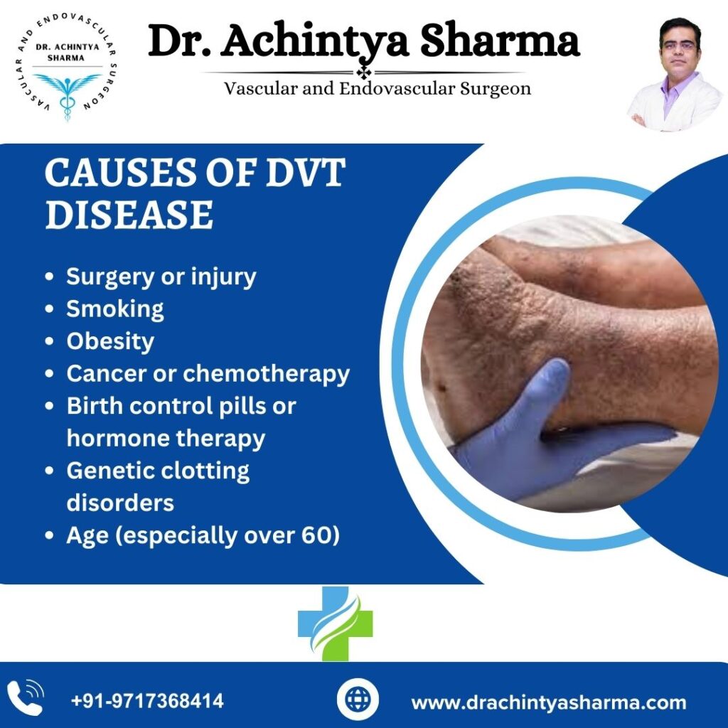 "Causes of DVT including lifestyle and genetic factors"






