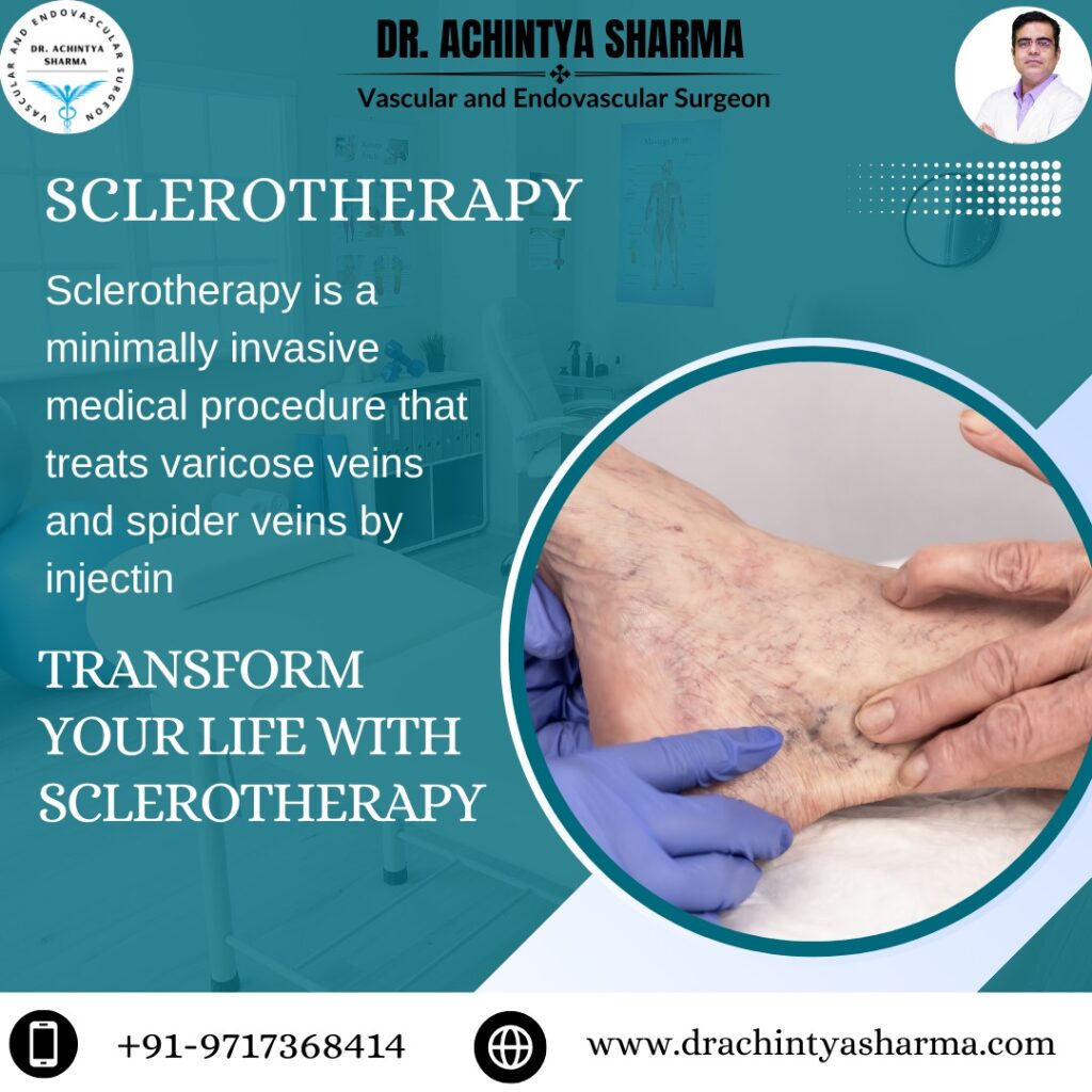 Sclerotherapy