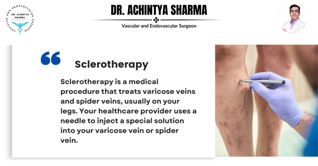 Sclerotheropy