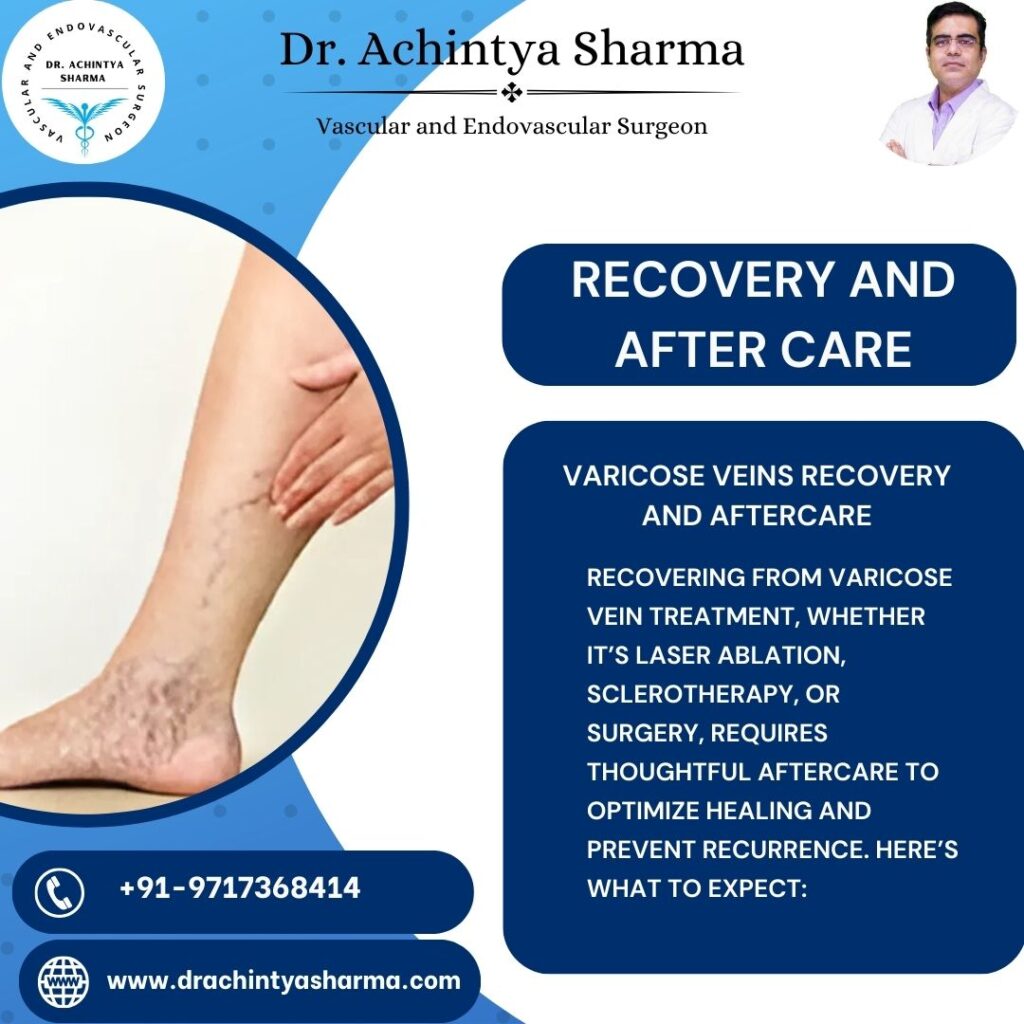 vericose veins removal