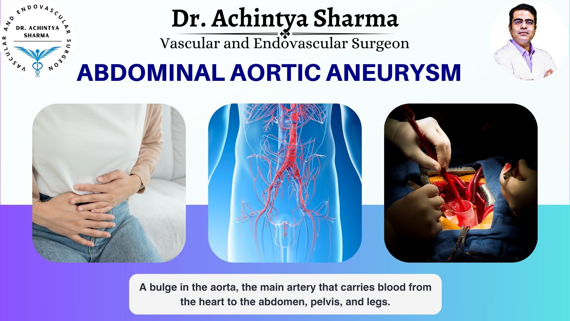 Abdominal Aortic Aneurysm: Identifying Risk and Advancing Life-Saving Interventions