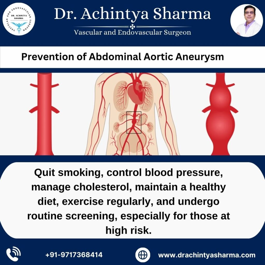 Aortic Aneurysm